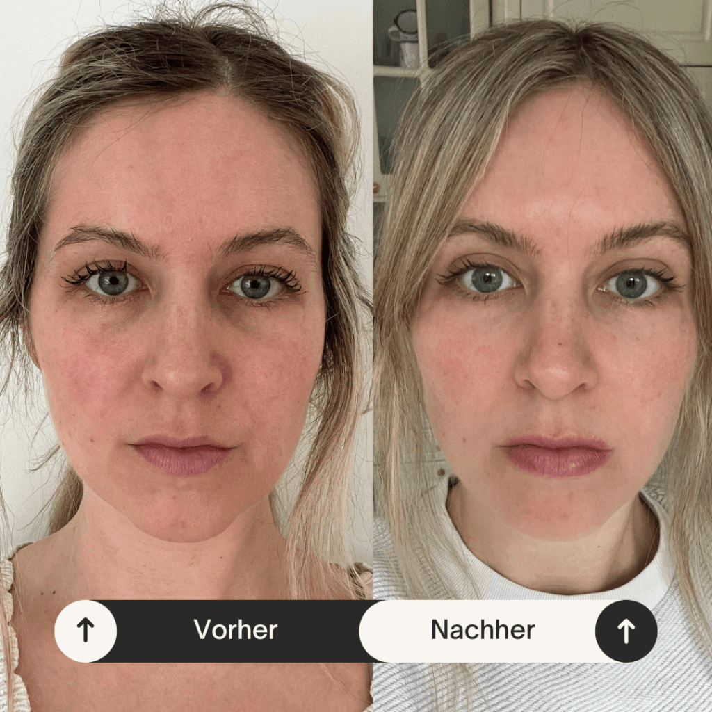 Vorher Nachher Gesichtstransformation vorne