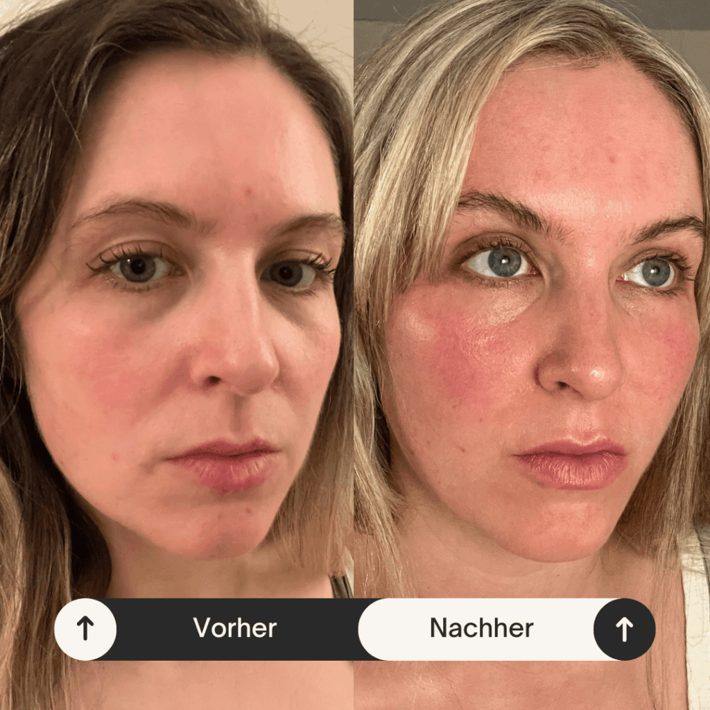 Beige Minimalist Skincare Before and After Instagram Post (3)-min