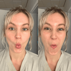 Gesichtstraining Wangenknochen