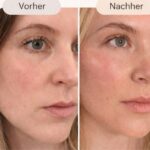 Vorher Nachher Transformation