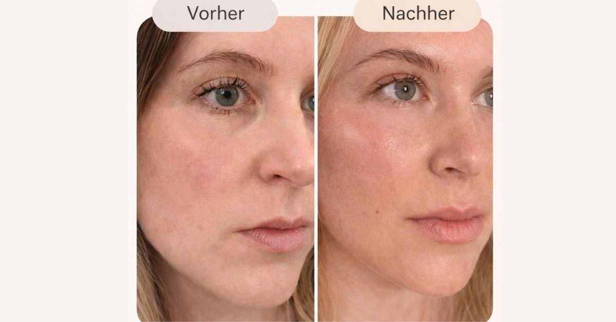 Vorher Nachher Transformation