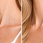 truthahnhals_1200x628 (1)