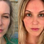 januar reset geschwollenes Gesicht