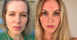 januar reset geschwollenes Gesicht